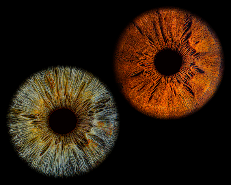 Uniqueye Iris Photography